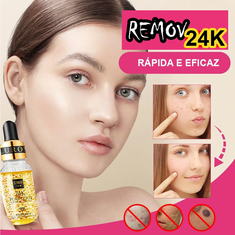 Remov 24K Gold