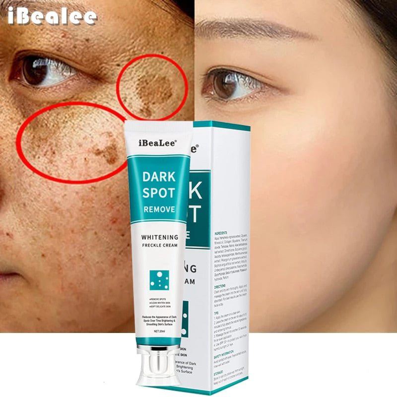 Dark Spot Creme Removedor